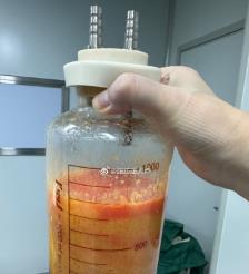 西宁水动力吸脂手术要做多久？